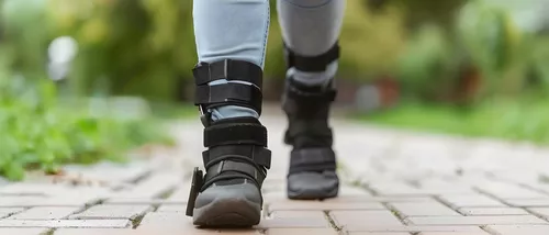 Co to jest orteza? Kompletny przewodnik po ortezach sportowych i rehabilitacyjnych
