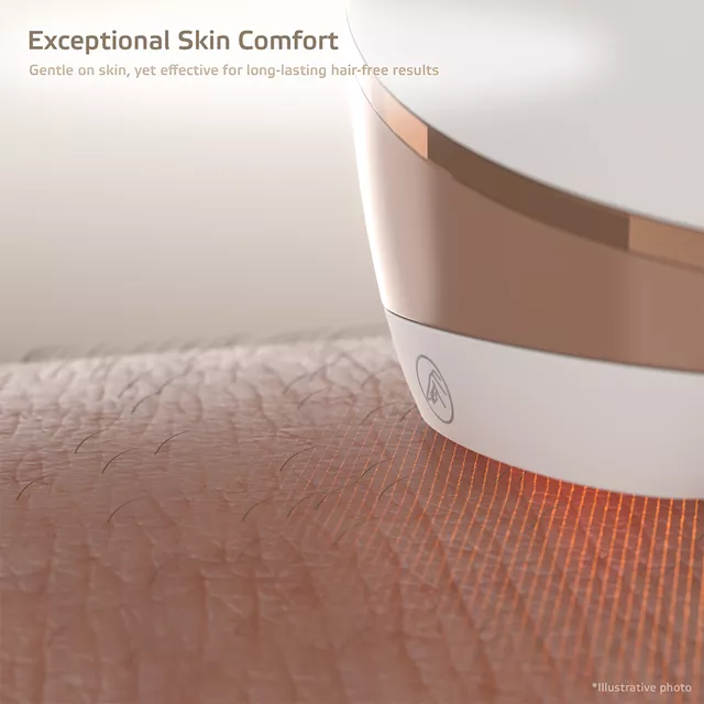 Depilator laserowy IPL inSPORTline Aphira ∙ 5 poziomów intensywności ∙ 990 000 błysków ∙ 3 nasadki ∙ okulary + tryb automatyczny