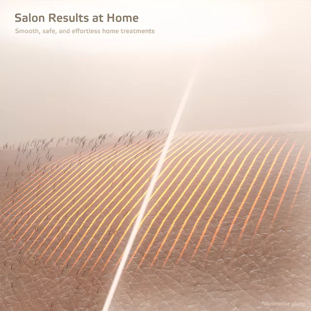 Depilator laserowy IPL inSPORTline Aphira ∙ 5 poziomów intensywności ∙ 990 000 błysków ∙ 3 nasadki ∙ okulary + tryb automatyczny