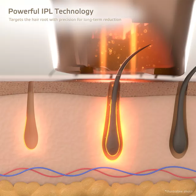 Depilator laserowy IPL inSPORTline Eriva ∙ 5 poziomów ∙ 400 000 błysków ∙ długość fali 510–1100 nm ∙ okulary + tryb automatyczny