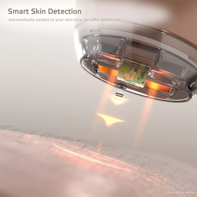 Depilator laserowy IPL inSPORTline Aphira ∙ 5 poziomów intensywności ∙ 990 000 błysków ∙ 3 nasadki ∙ okulary + tryb automatyczny