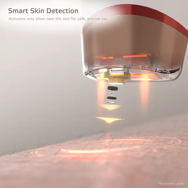 Depilator laserowy IPL inSPORTline Eriva ∙ 5 poziomów ∙ 400 000 błysków ∙ długość fali 510–1100 nm ∙ okulary + tryb automatyczny